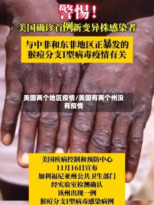 美国两个地区疫情/美国有两个州没有疫情-第1张图片